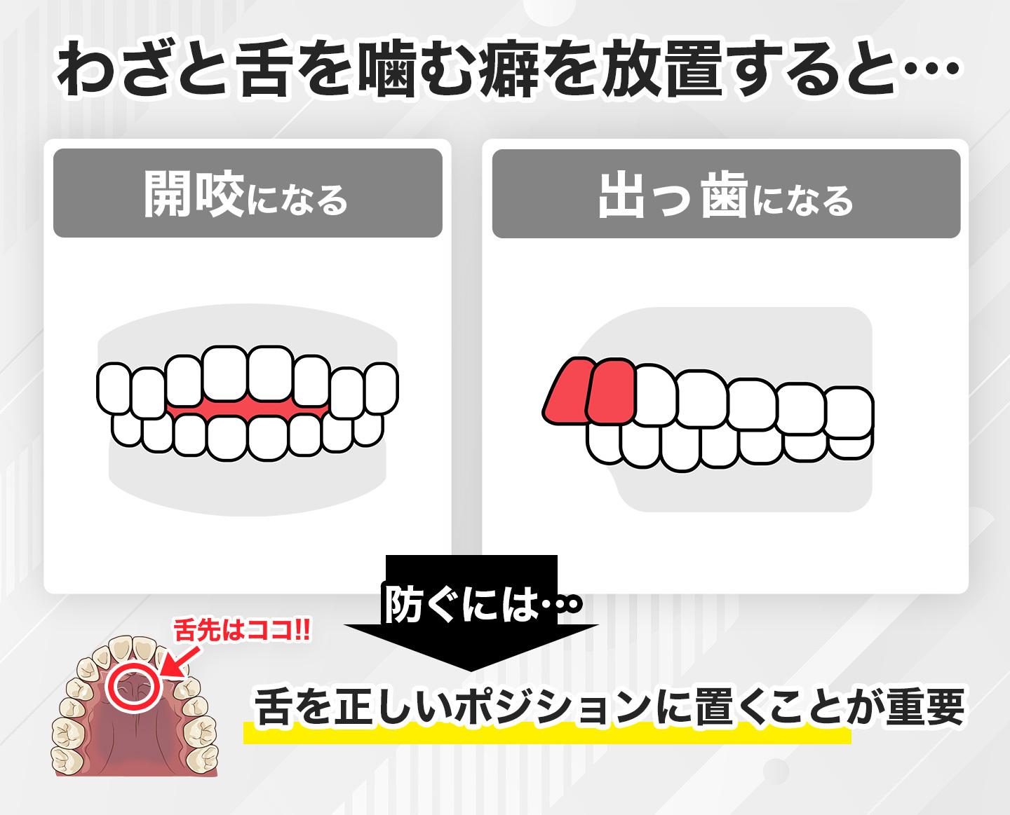 わざと舌を噛む癖を放置するリスク
