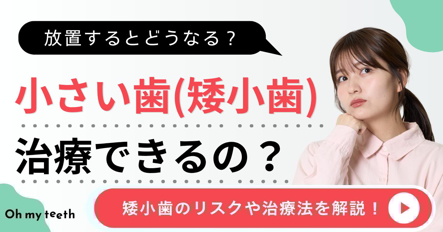 歯が小さい アイキャッチ