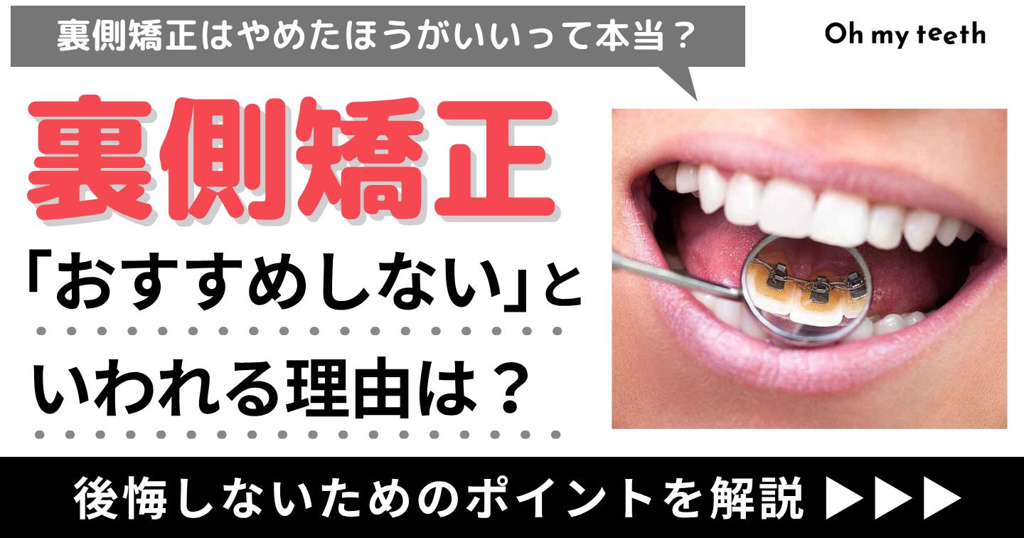 裏側矯正 おすすめしない アイキャッチ