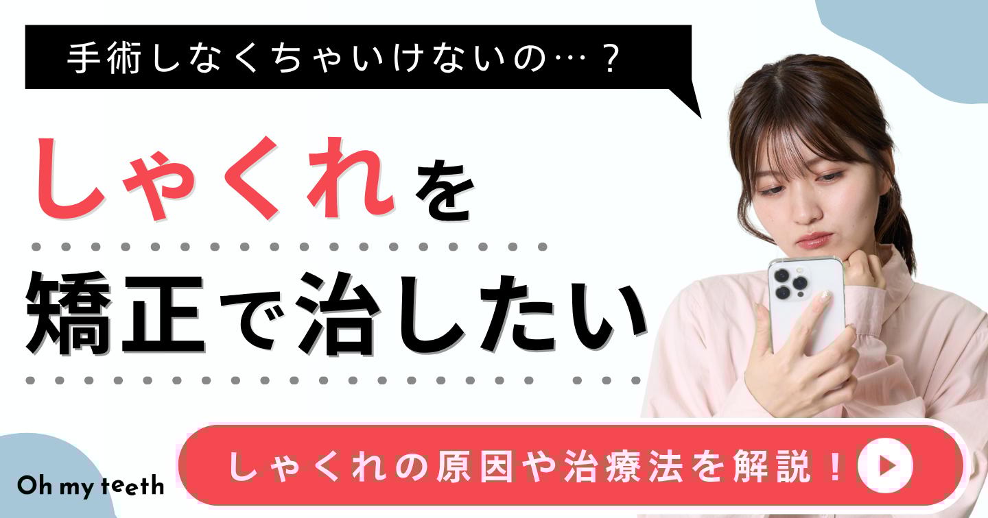 しゃくれ アイキャッチ