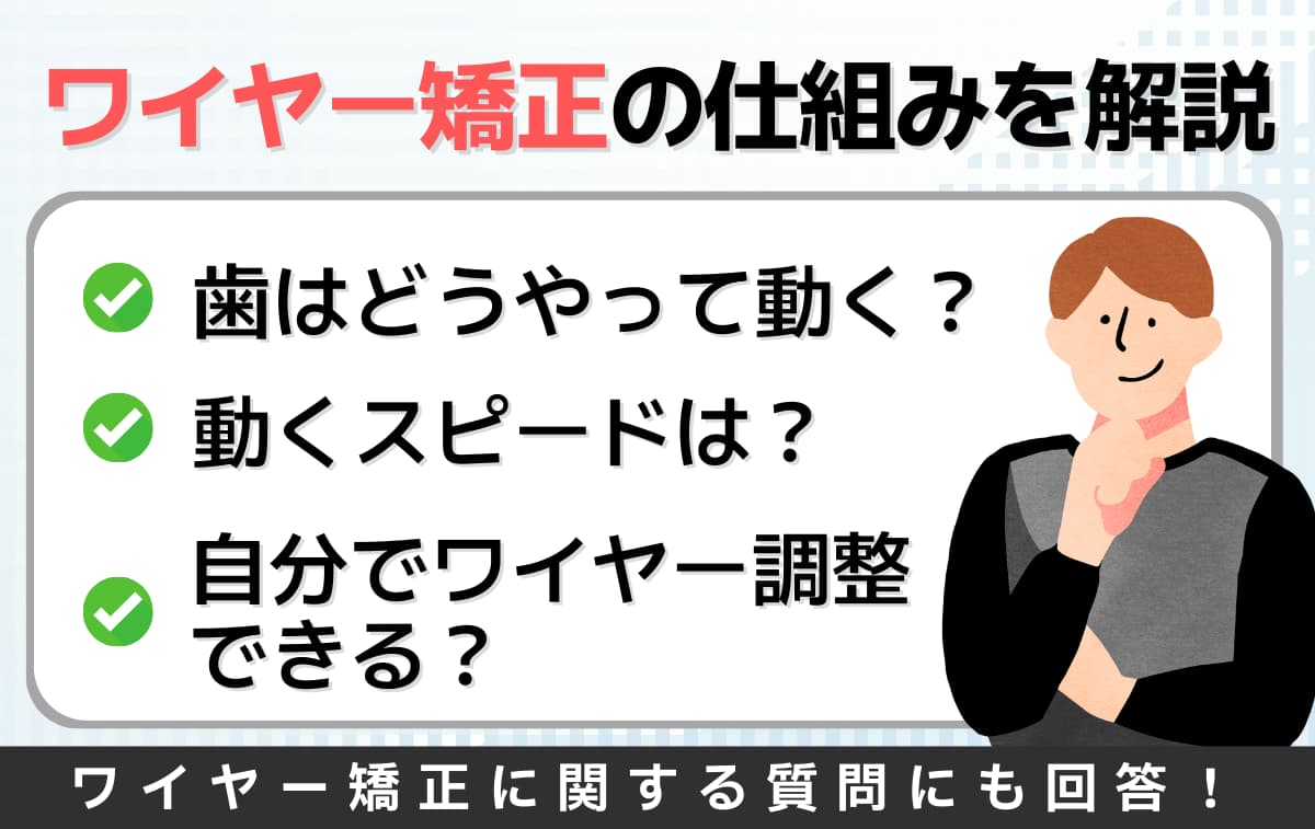 ワイヤー矯正 仕組み アイキャッチ