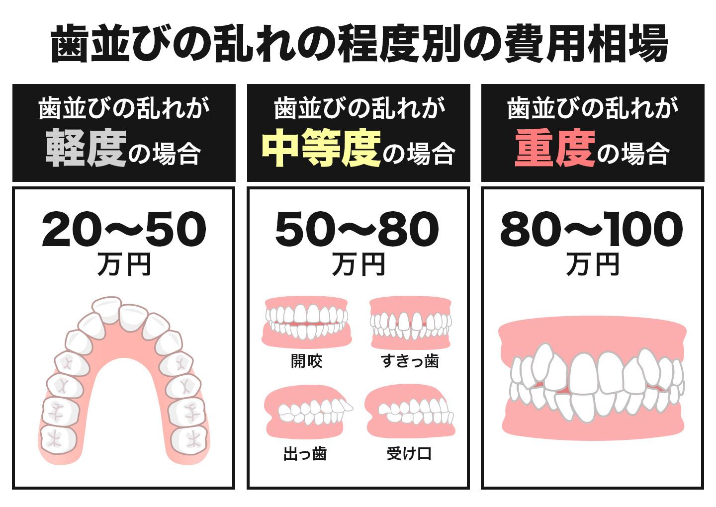 歯並びの乱れの程度別の費用相場