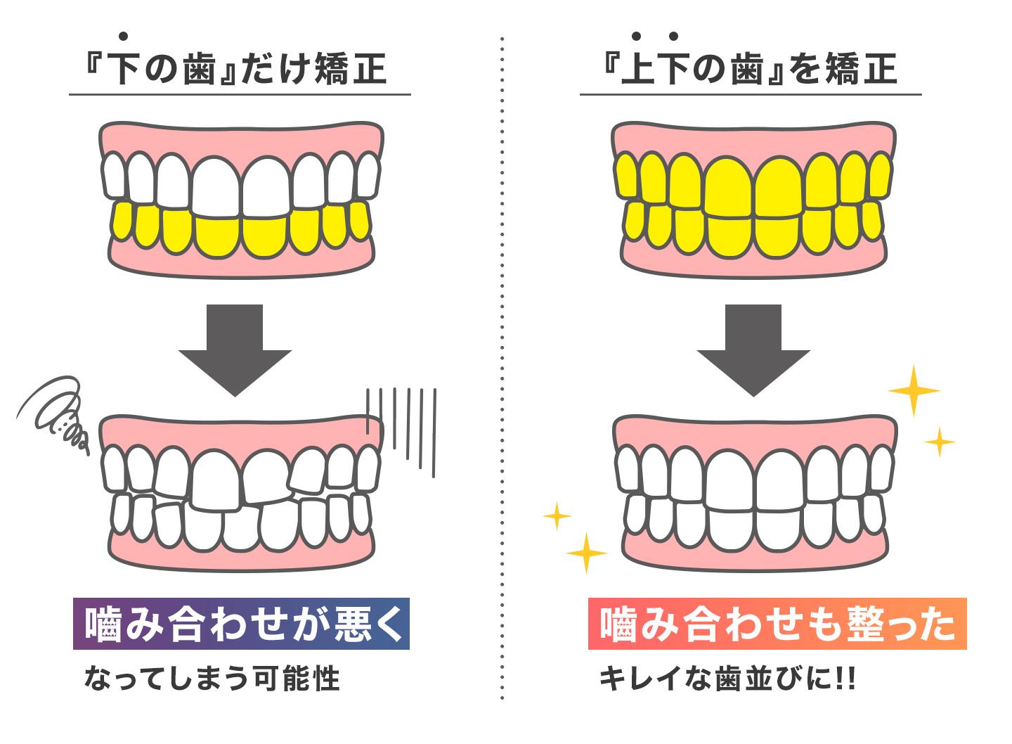 部分矯正のパターン例