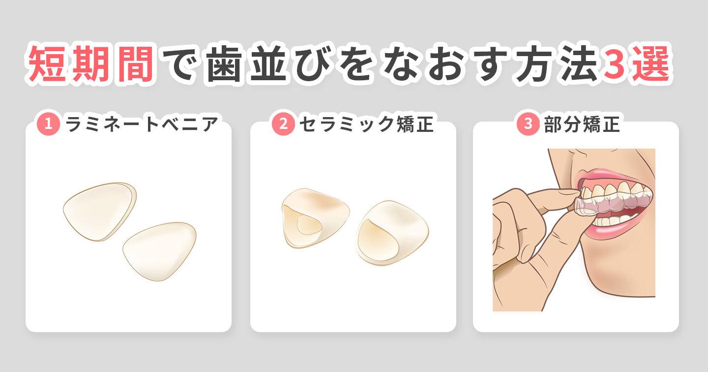 そんなに悪くない歯並びなおす3選