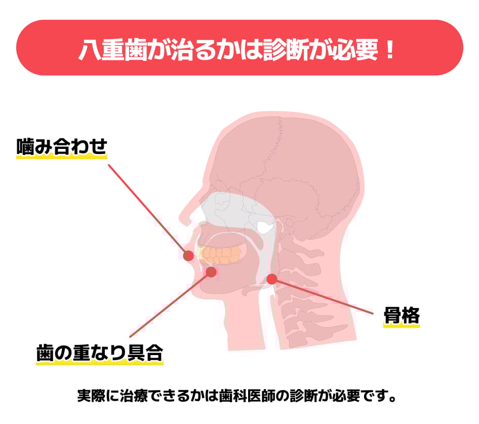 八重歯3