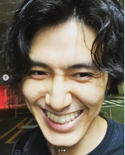 藤井風インビザライン画像2