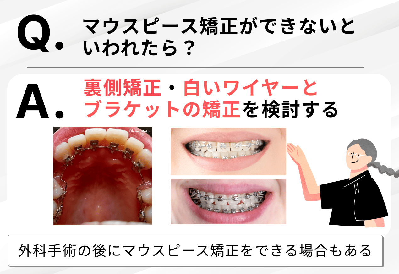 マウスピース矯正ができない場合の治療法2選