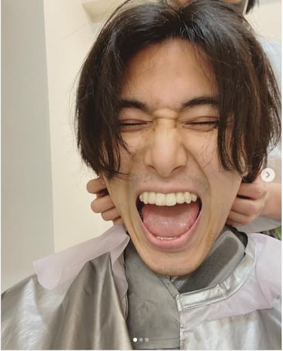藤井風インビザライン画像