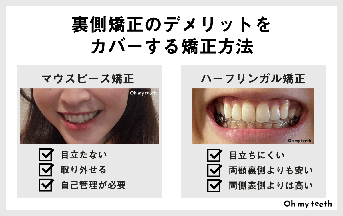 裏側矯正のデメリットをカバーする方法