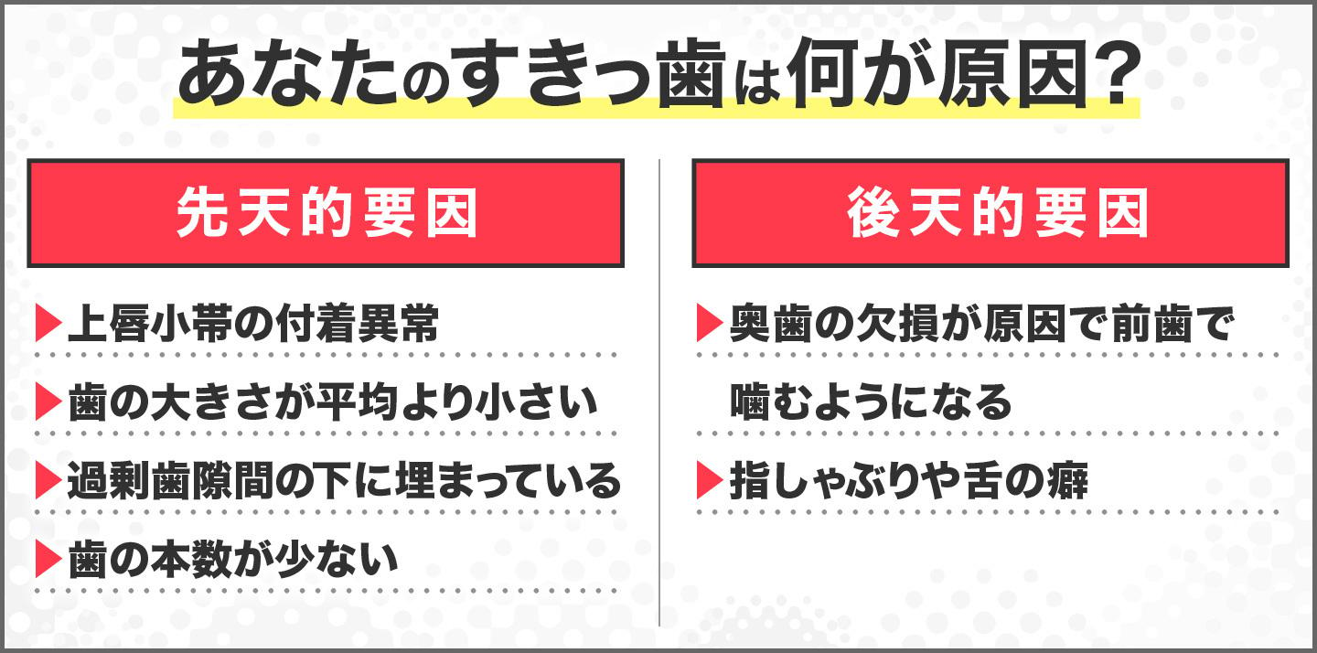 あなたのすきっ歯は何が原因？