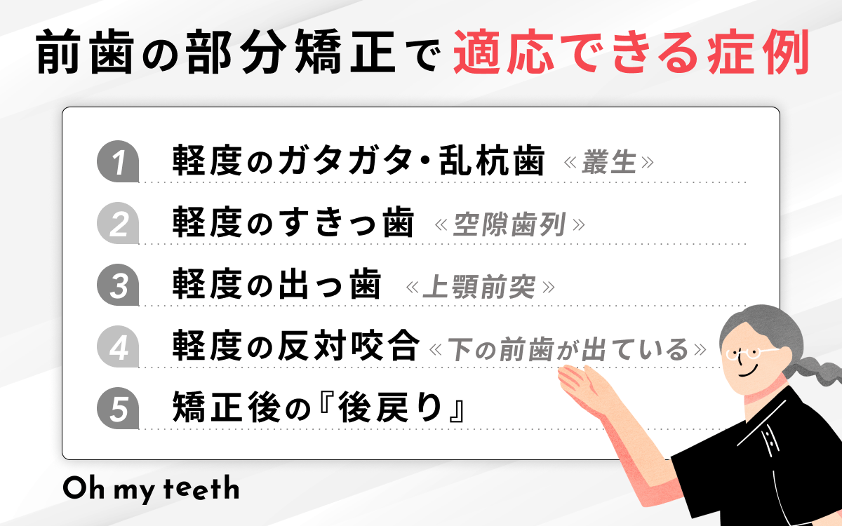 前歯だけの矯正で対応できる5つのケース【適応症例】