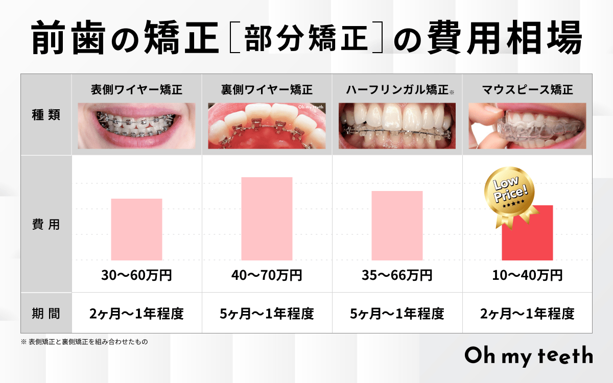 前歯だけ矯正の費用・期間はどのくらい？