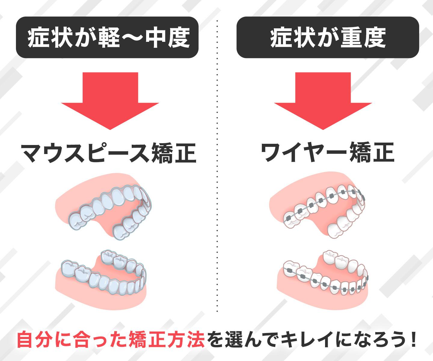 【ワイヤー矯正?マウスピース矯正?】自分に合った種類の選び方