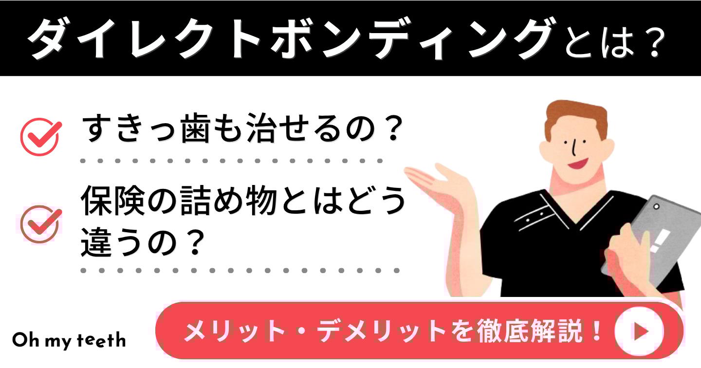 ダイレクトボンディング アイキャッチ