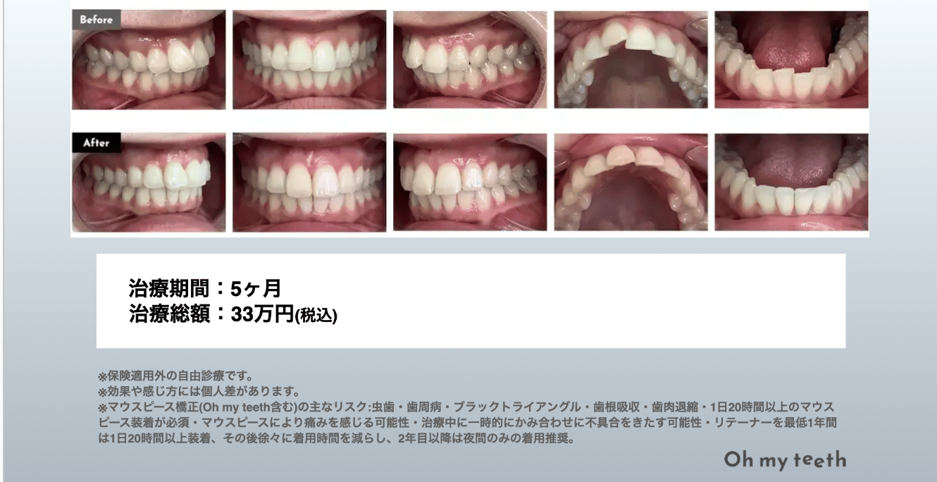 症例 BA 5写真