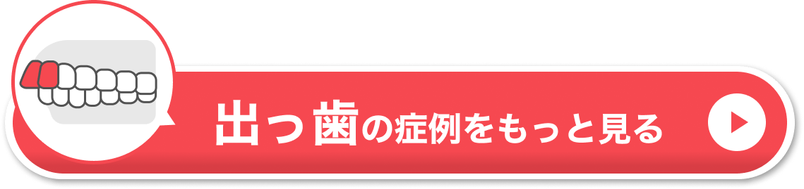 出っ歯の症例をもっと見る