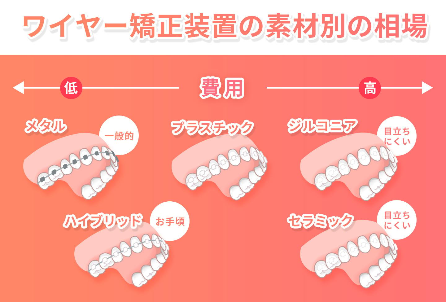 ワイヤー矯正相場6素材別