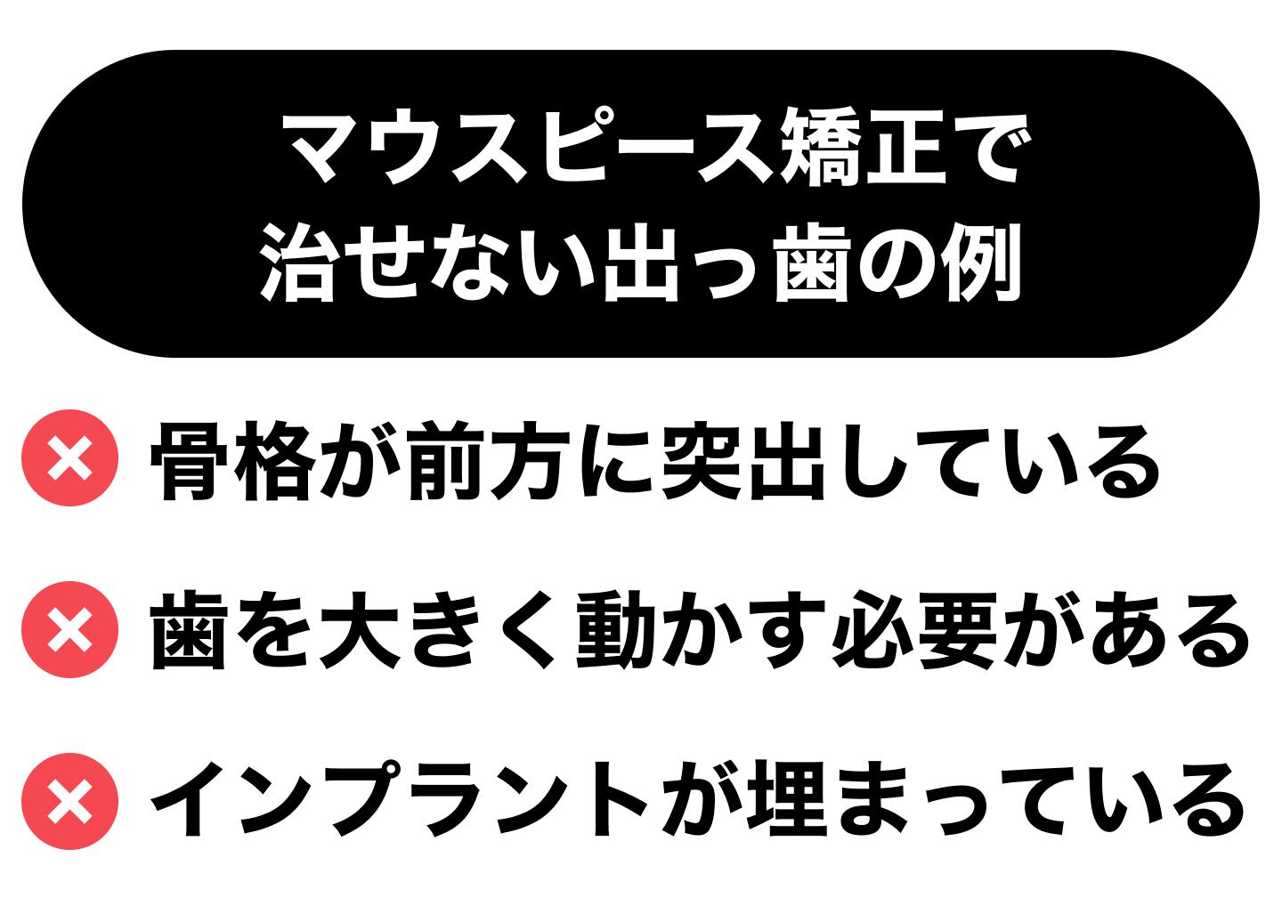 マウスピース矯正で治せない出っ歯の例