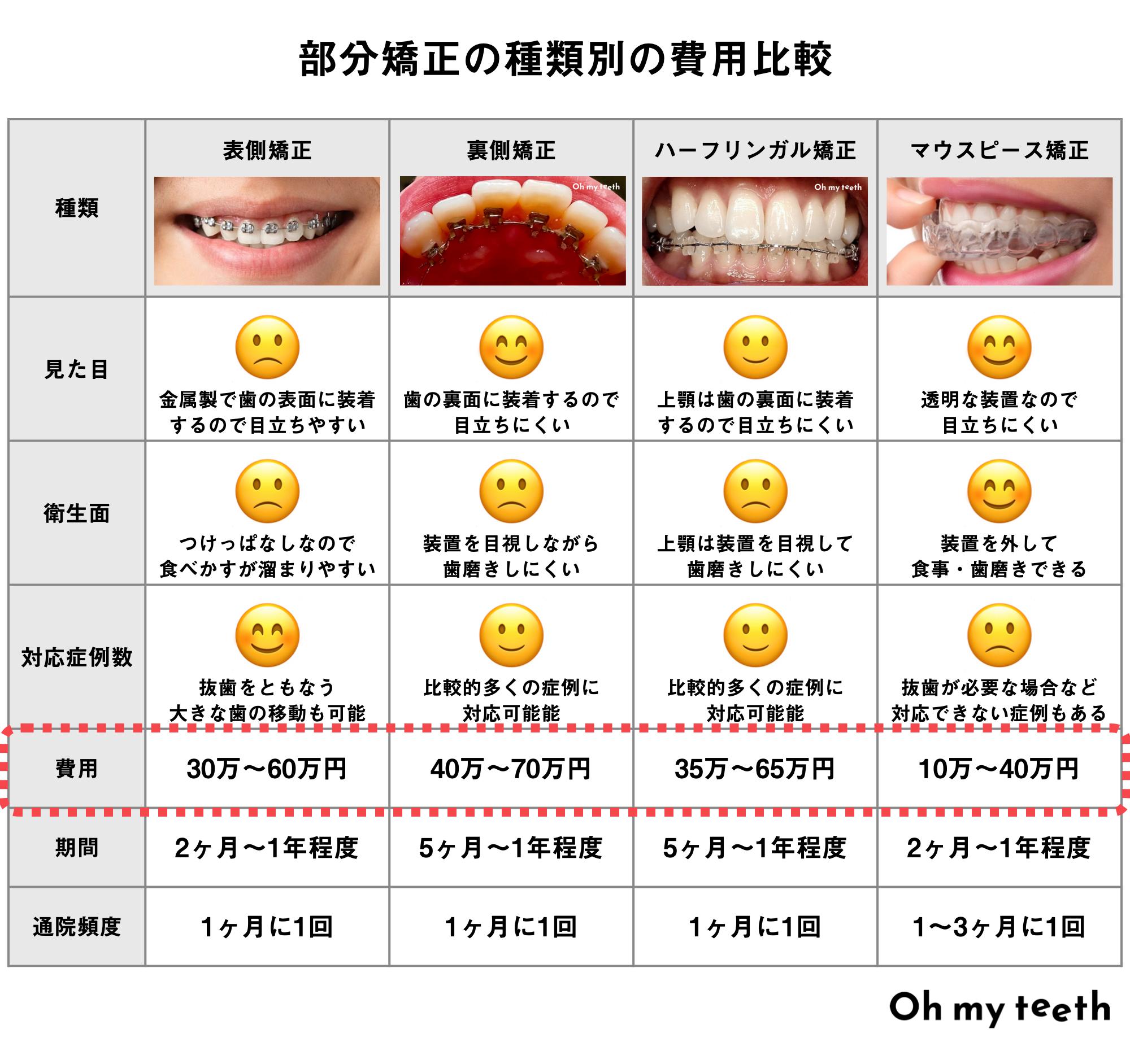 部分矯正の種類別の費用比較