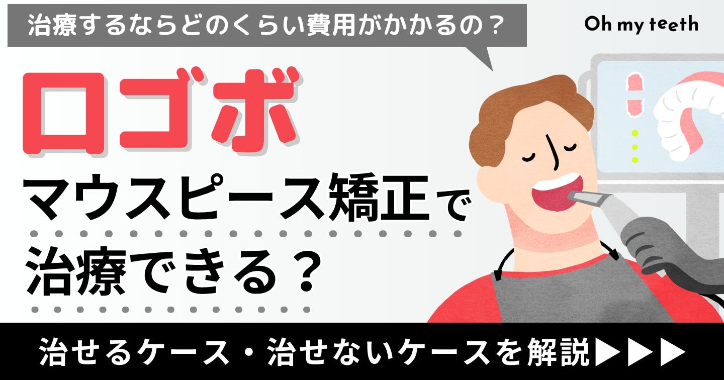 口ゴボ マウスピース矯正 アイキャッチ