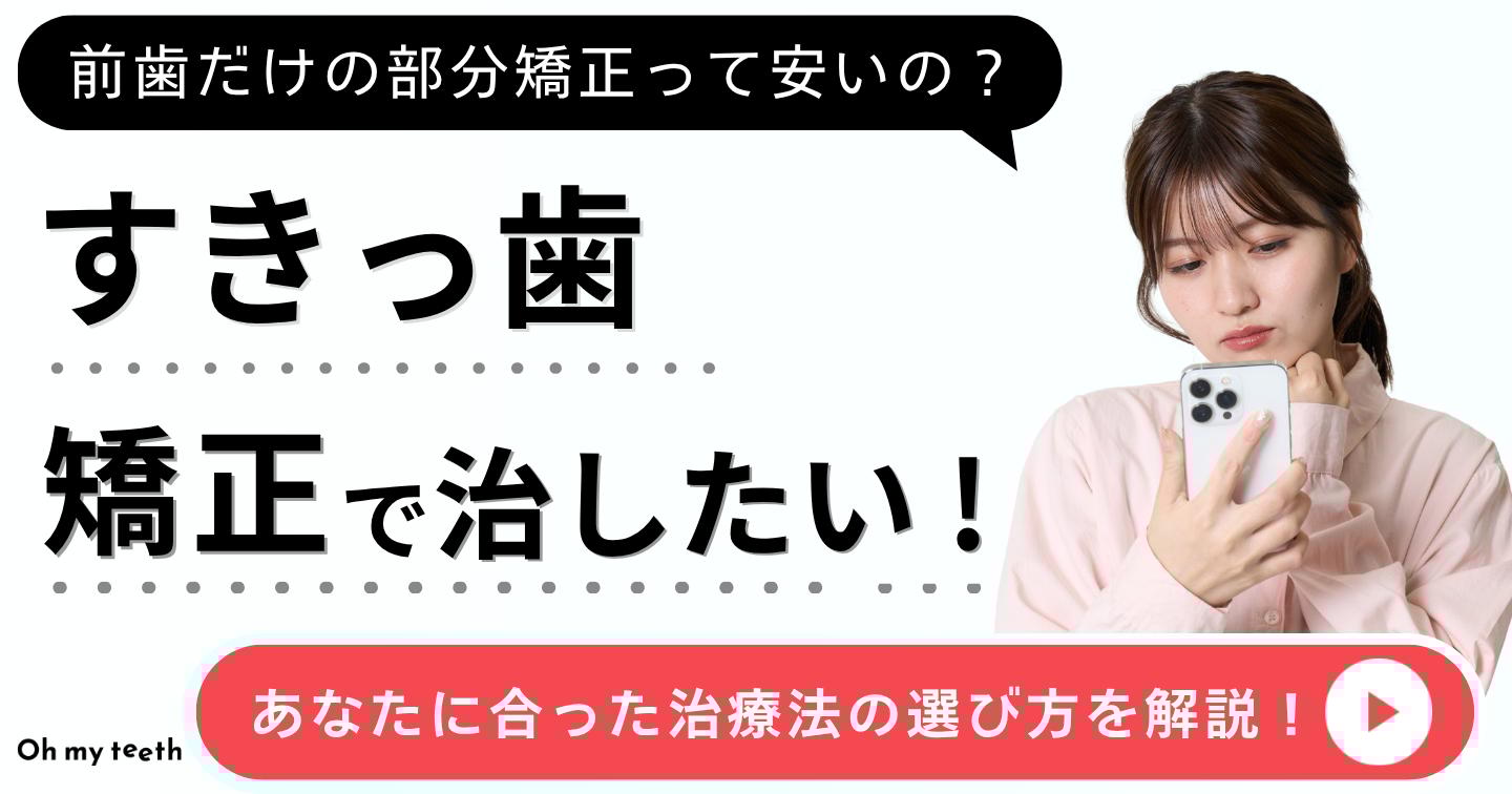 すきっ歯 矯正アイキャッチ