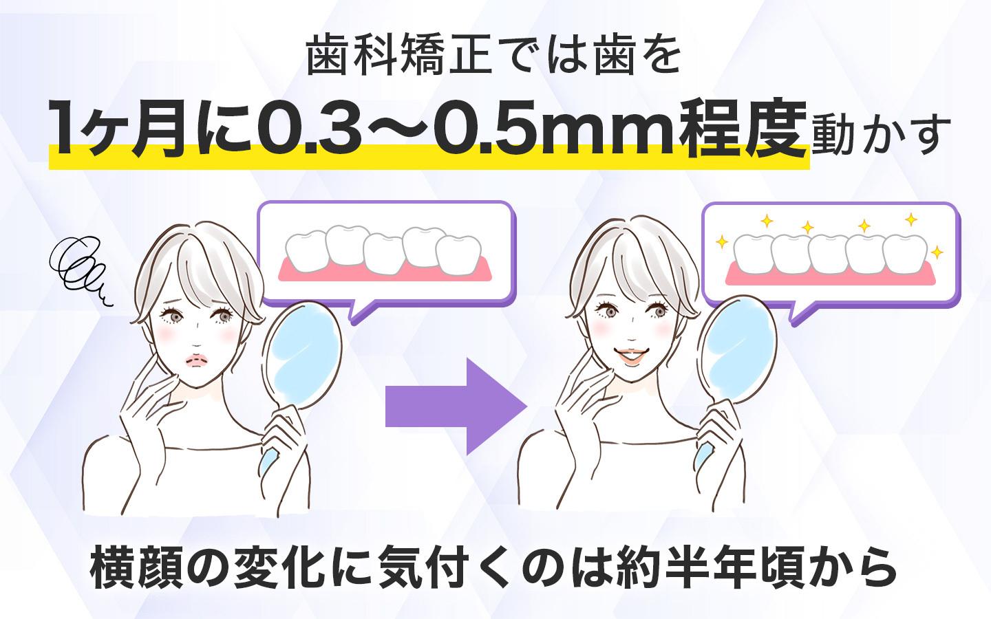 歯列矯正では1ヶ月で約0.3〜0.5mm程度歯を動かす