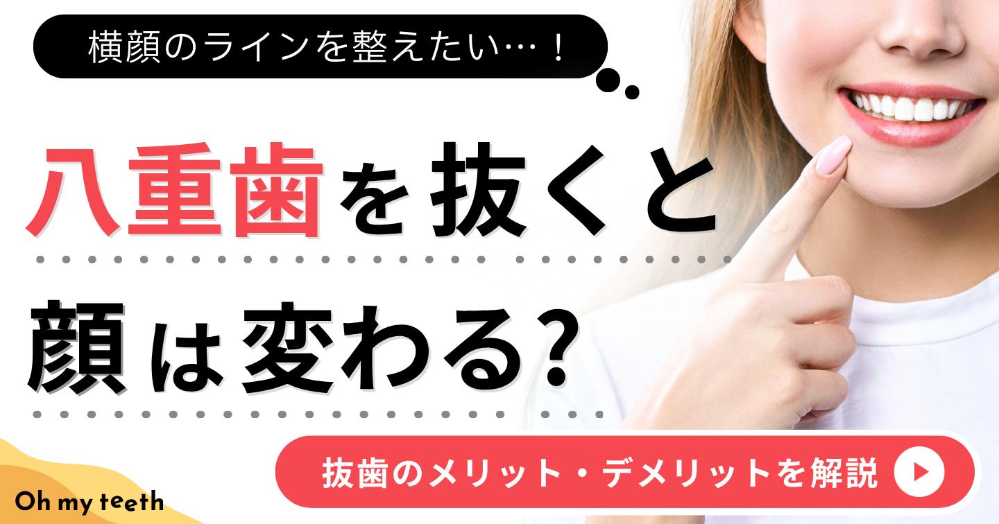 八重歯 を抜くと アイキャッチ