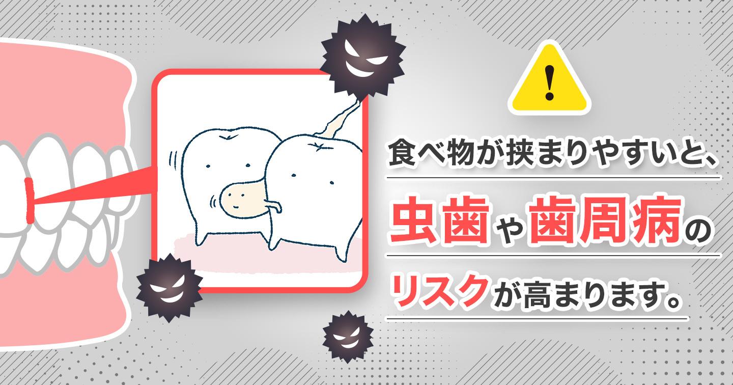 歯に挟まるとリスクが高まる