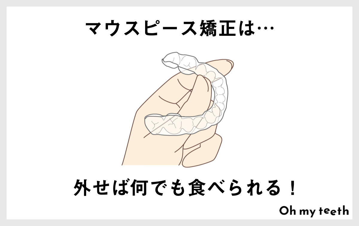 マウスピース矯正は外せばなんでも食べられる