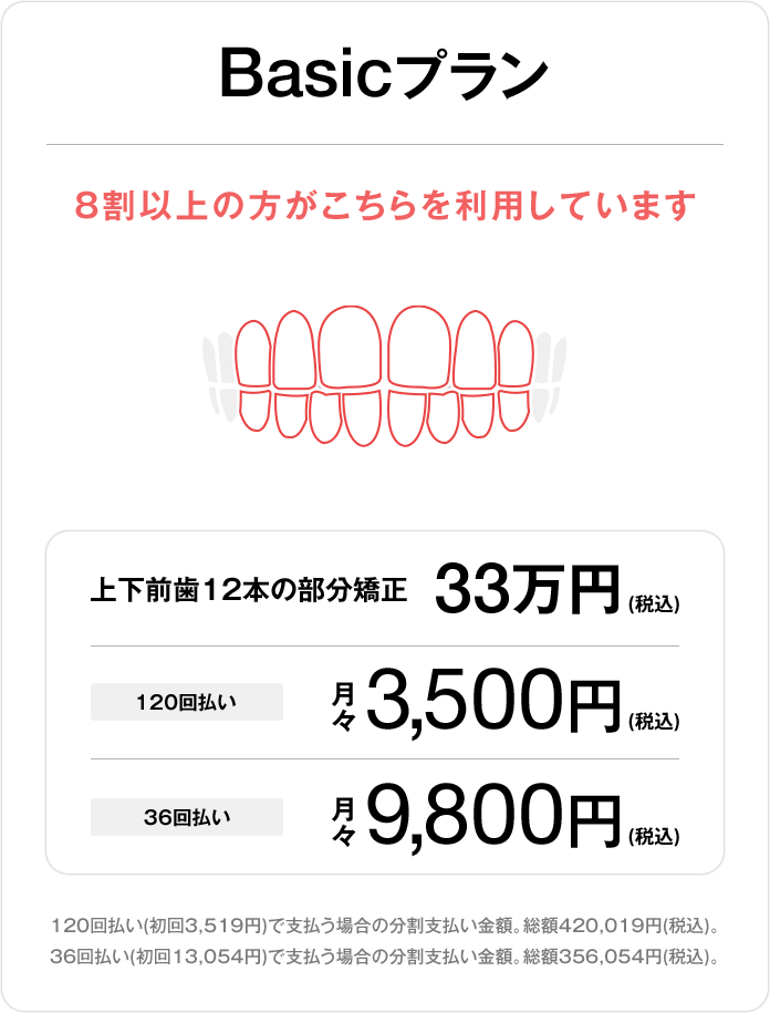 Basicプラン、上下前歯12本の部分矯正33万円(税込)、120回払い 月々3,500円(税込)、36回払い 月々9,800円(税込)