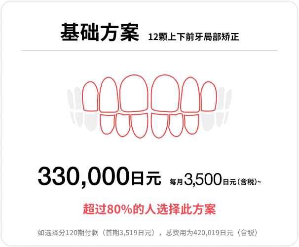 Basicプラン、上下前歯12本の部分矯正、33万円、月々（税込）3,500円〜