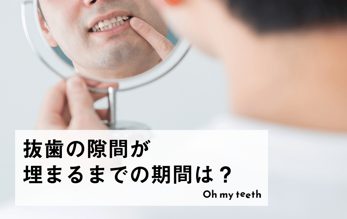 矯正で抜歯すると隙間はどれくらいで埋まる？