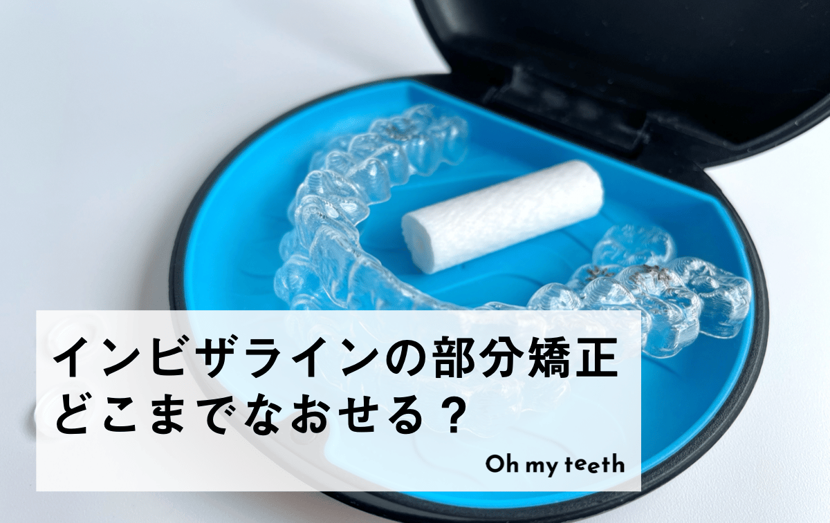 インビザラインの部分矯正の適応症例や費用目安など徹底解説