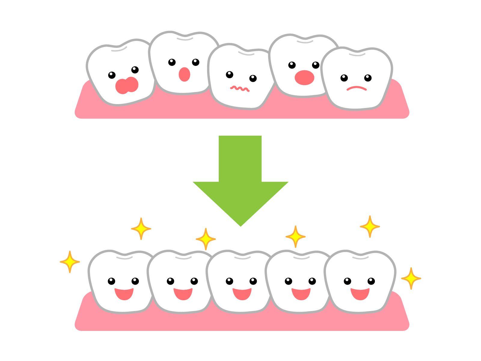 歯がきれいに並ぶイラスト